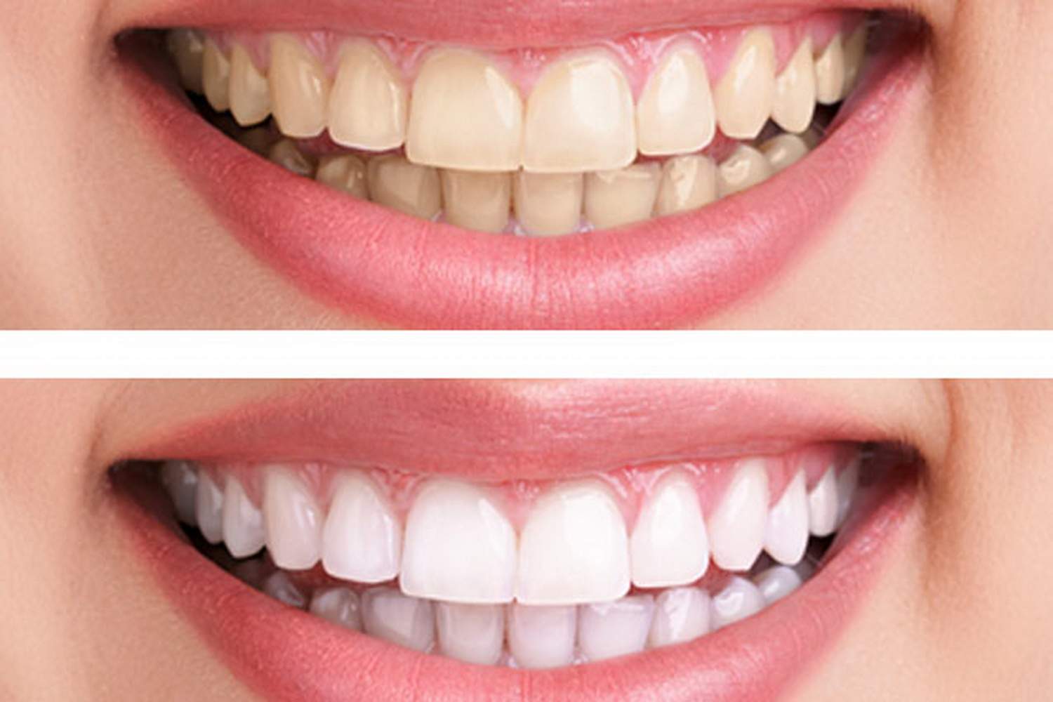 Odontología Estética